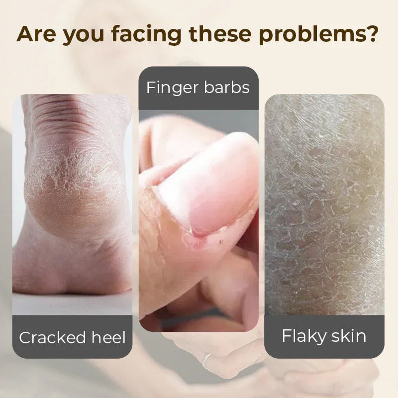 🎉Buy 2 Get 1 Free🎉Hydrating and Anti-Cracking Foot Cream